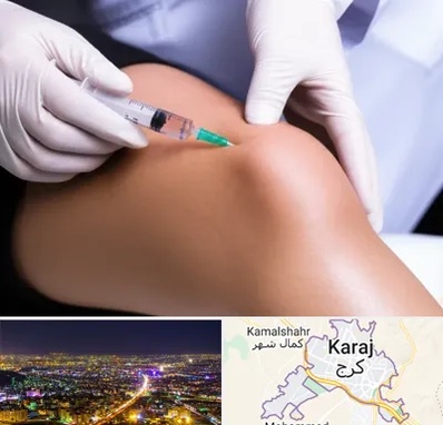 پلاسما درمانی PRP در کرج