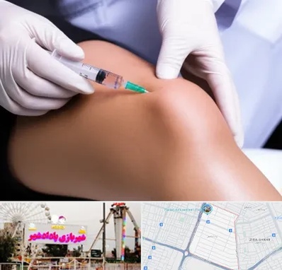 پلاسما درمانی PRP در پادادشهر اهواز 