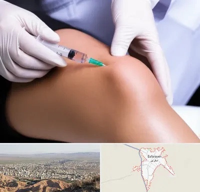 پلاسما درمانی PRP در اسفراین