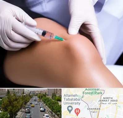 پلاسما درمانی PRP در شهران 