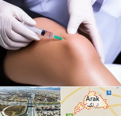 پلاسما درمانی PRP در اراک