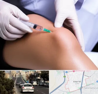 پلاسما درمانی PRP در خطیب تبریز 