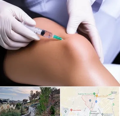 پلاسما درمانی PRP در باغستان کرج 