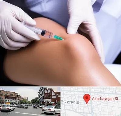 پلاسما درمانی PRP در خیابان آذربایجان