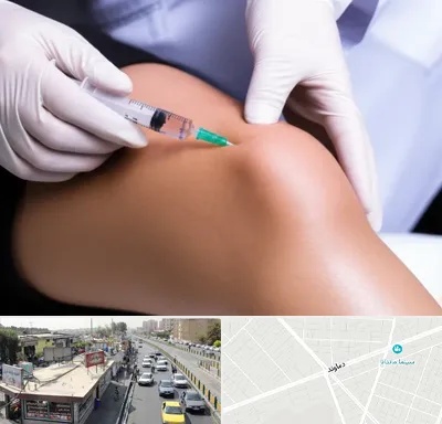 پلاسما درمانی PRP در خیابان دماوند