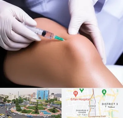 پلاسما درمانی PRP در ونک 