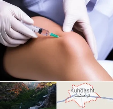 پلاسما درمانی PRP در کوهدشت