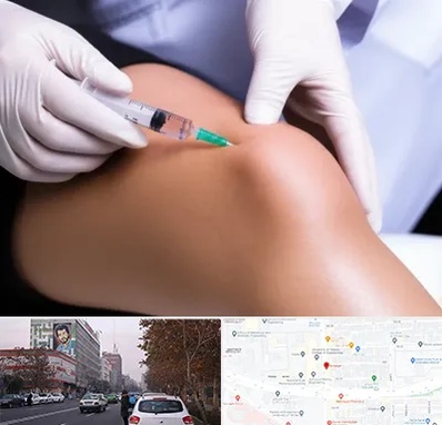 پلاسما درمانی PRP در کارگر شمالی