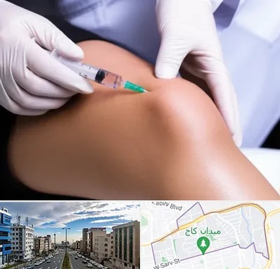 پلاسما درمانی PRP در سعادت آباد 