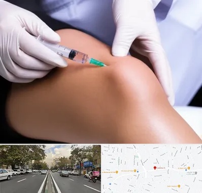 پلاسما درمانی PRP در دولت 