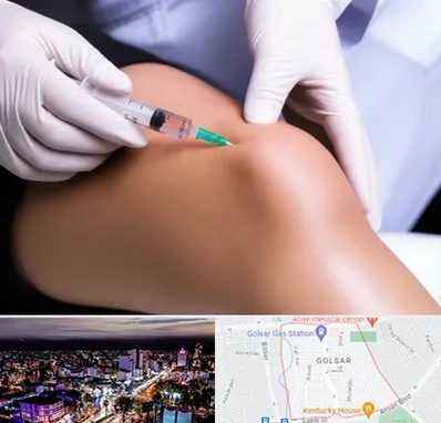 پلاسما درمانی PRP در گلسار رشت 