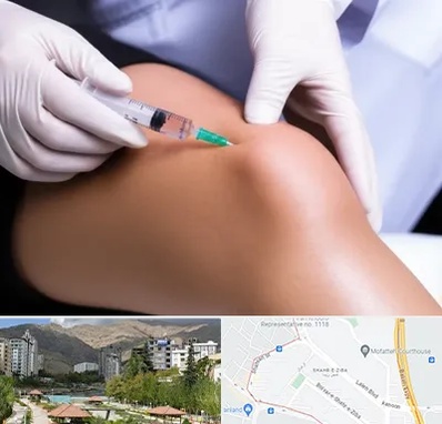 پلاسما درمانی PRP در شهر زیبا 