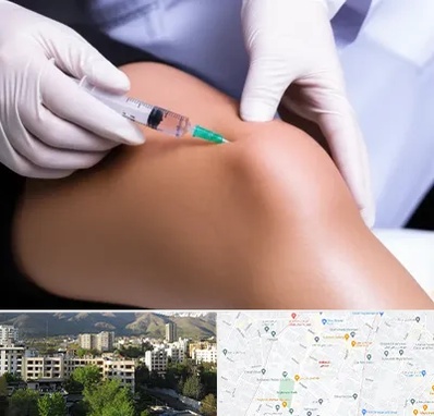 پلاسما درمانی PRP در دیباجی 