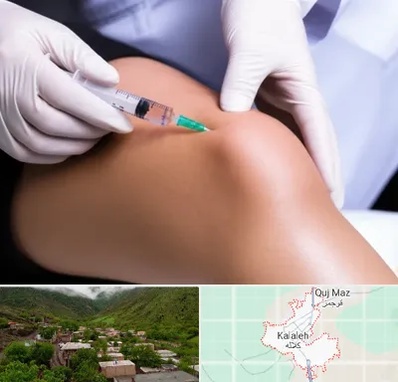 پلاسما درمانی PRP در کلاله