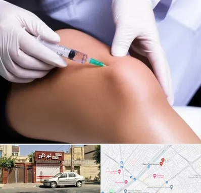 پلاسما درمانی PRP در باجک قم 