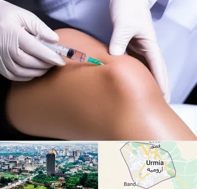 پلاسما درمانی PRP در ارومیه