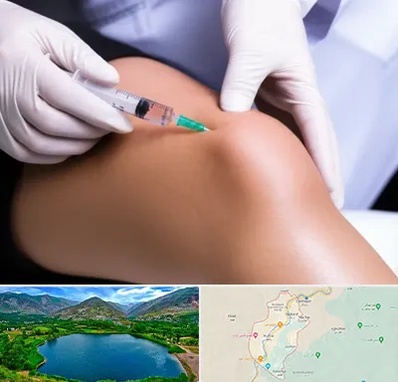 پلاسما درمانی PRP در رودبار