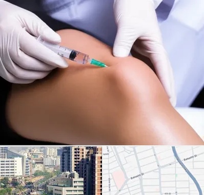 پلاسما درمانی PRP در خیابان بهشتی 