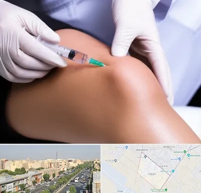 پلاسما درمانی PRP در کیانمهر کرج 