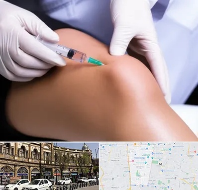 پلاسما درمانی PRP در منطقه 11 تهران 
