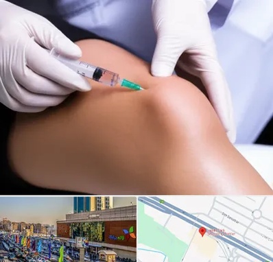 پلاسما درمانی PRP در لاله پارک تبریز 