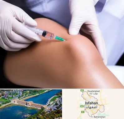 پلاسما درمانی PRP در اصفهان