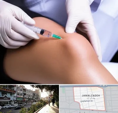 پلاسما درمانی PRP در خیابان جمالزاده 