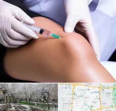 پلاسما درمانی PRP در باغ فیض 