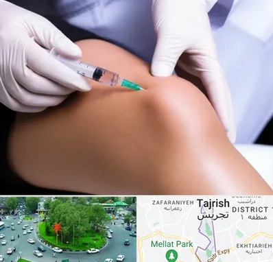 پلاسما درمانی PRP در تجریش 