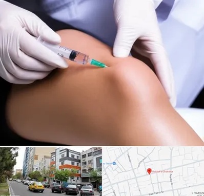 پلاسما درمانی PRP در هفده شهریور تبریز 