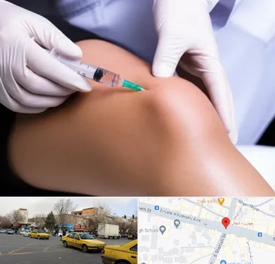 پلاسما درمانی PRP در شهناز تبریز 