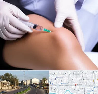 پلاسما درمانی PRP در ضیابری رشت 