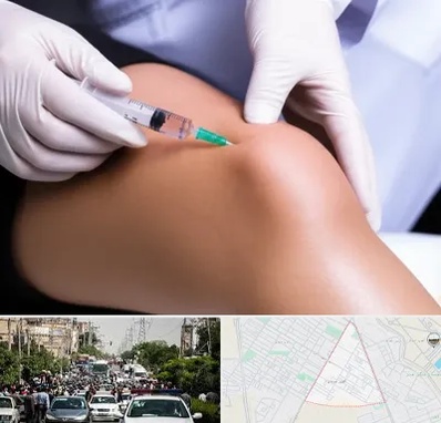 پلاسما درمانی PRP در سیدی مشهد 