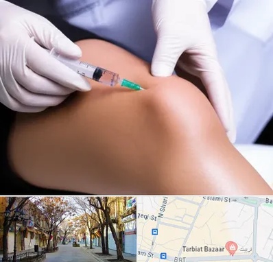 پلاسما درمانی PRP در تربیت تبریز 