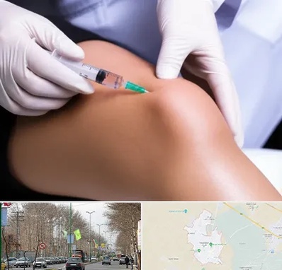 پلاسما درمانی PRP در نظرآباد کرج 