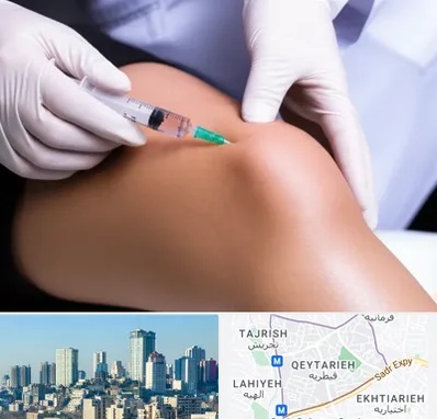 پلاسما درمانی PRP در قیطریه 