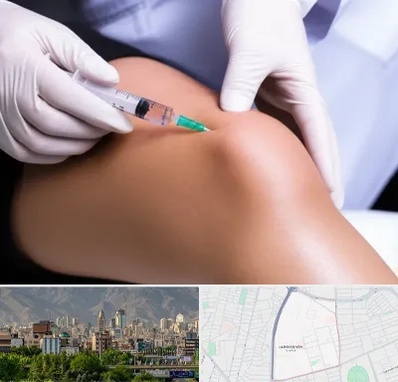 پلاسما درمانی PRP در جمشیدیه 
