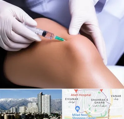 پلاسما درمانی PRP در شهرک غرب