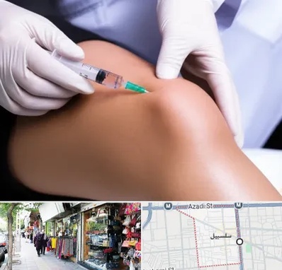 پلاسما درمانی PRP در سلسبیل