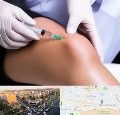 پلاسما درمانی PRP در تهرانپارس 