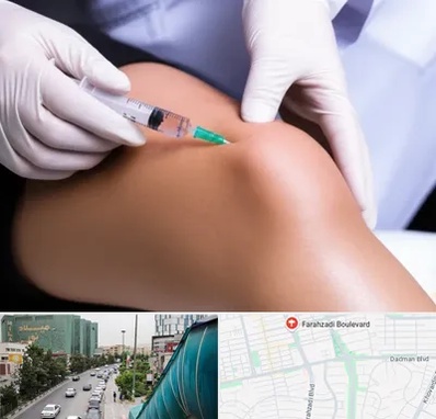 پلاسما درمانی PRP در بلوار فرحزادی 