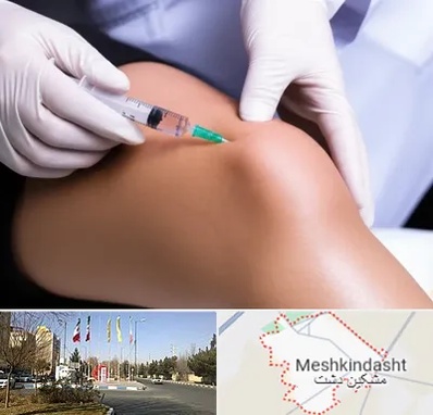 پلاسما درمانی PRP در مشکین دشت
