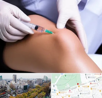 پلاسما درمانی PRP در بلوار کشاورز