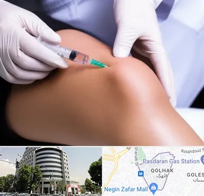 پلاسما درمانی PRP در قلهک 