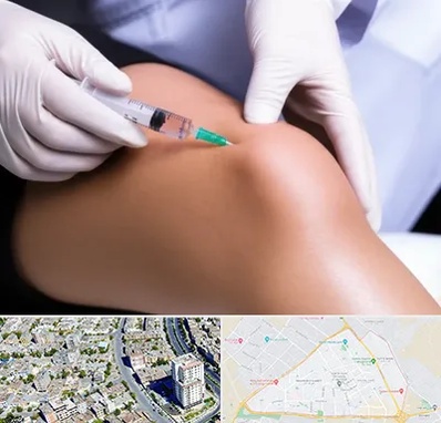 پلاسما درمانی PRP در قاسم آباد مشهد 