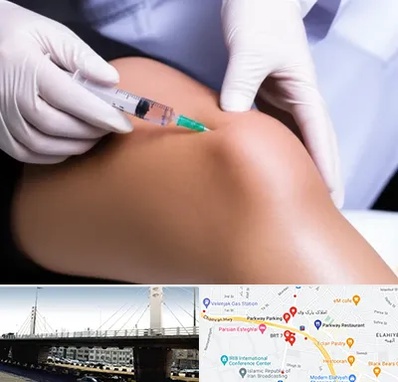 پلاسما درمانی PRP در پارک وی