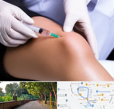 پلاسما درمانی PRP در بلوار گیلان رشت 