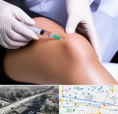 پلاسما درمانی PRP در فرجام 