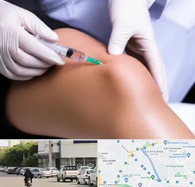 پلاسما درمانی PRP در قدوسی شرقی شیراز 