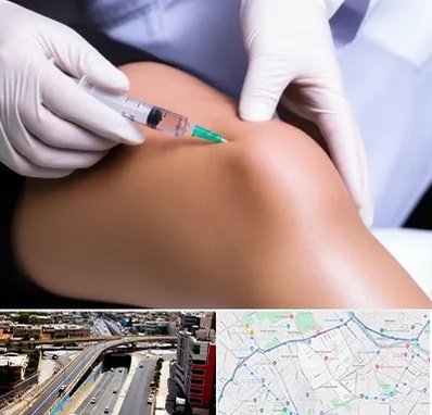 پلاسما درمانی PRP در ستارخان شیراز 